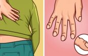 Šie ir izplatītākie vēža simptomi, kurus cilvēki pārsvarā ignorē! Uzmanīgi izlasiet Šie ir izplatītākie vēža simptomi, kurus cilvēki pārsvarā ignorē! Uzmanīgi izlasiet